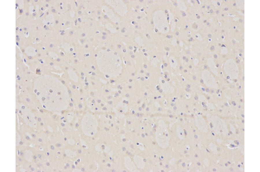 Immunohistochemistry - BID Antibody from Signalway Antibody (32014) - Antibodies.com