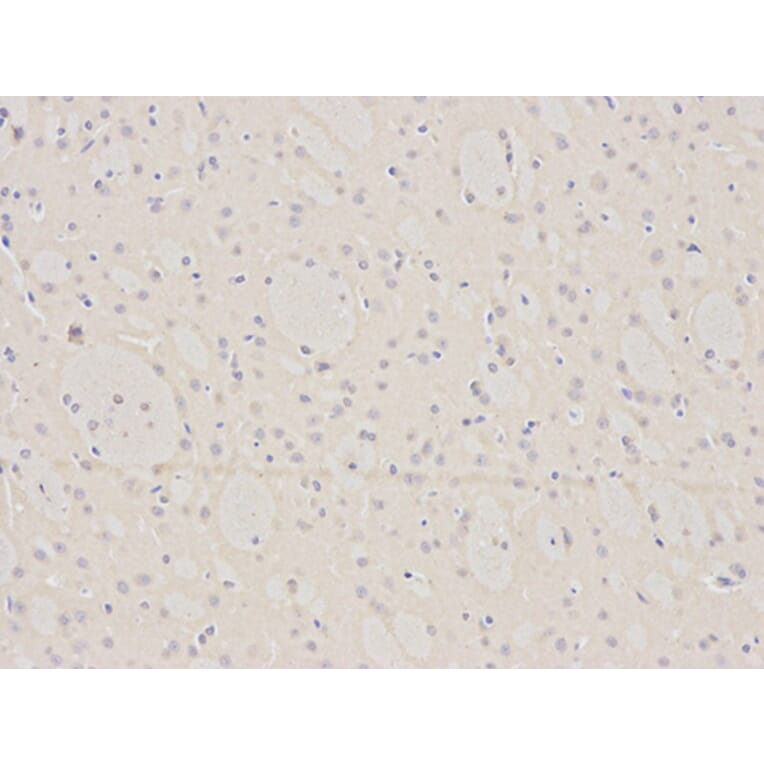 Immunohistochemistry - BID Antibody from Signalway Antibody (32014) - Antibodies.com