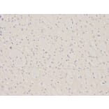 Immunohistochemistry - BID Antibody from Signalway Antibody (32014) - Antibodies.com