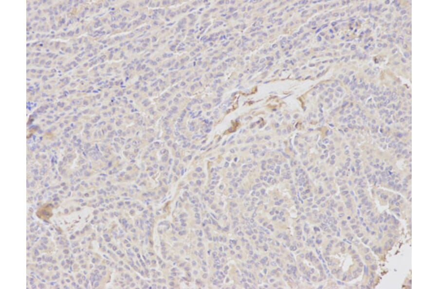 Immunohistochemistry - BID Antibody from Signalway Antibody (32014) - Antibodies.com