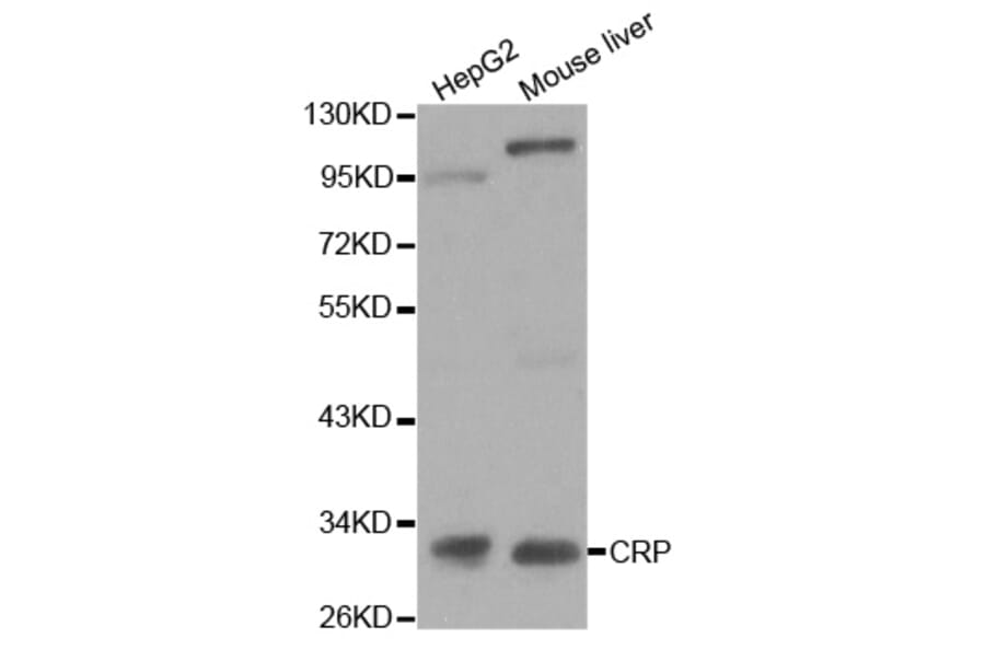 Western blot - CRP Antibody from Signalway Antibody (32023) - Antibodies.com