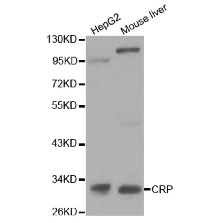 Western blot - CRP Antibody from Signalway Antibody (32023) - Antibodies.com