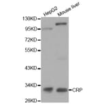 Western blot - CRP Antibody from Signalway Antibody (32023) - Antibodies.com