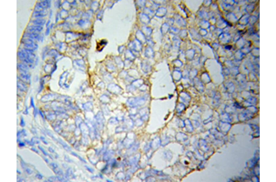 Immunohistochemistry - CRP Antibody from Signalway Antibody (32023) - Antibodies.com