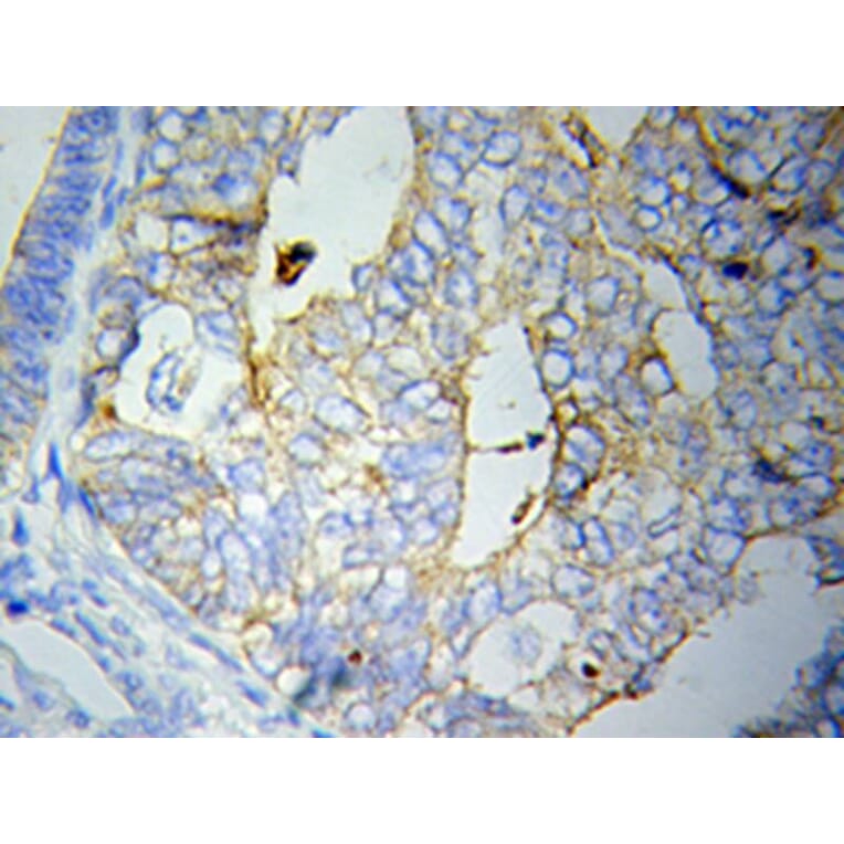 Immunohistochemistry - CRP Antibody from Signalway Antibody (32023) - Antibodies.com