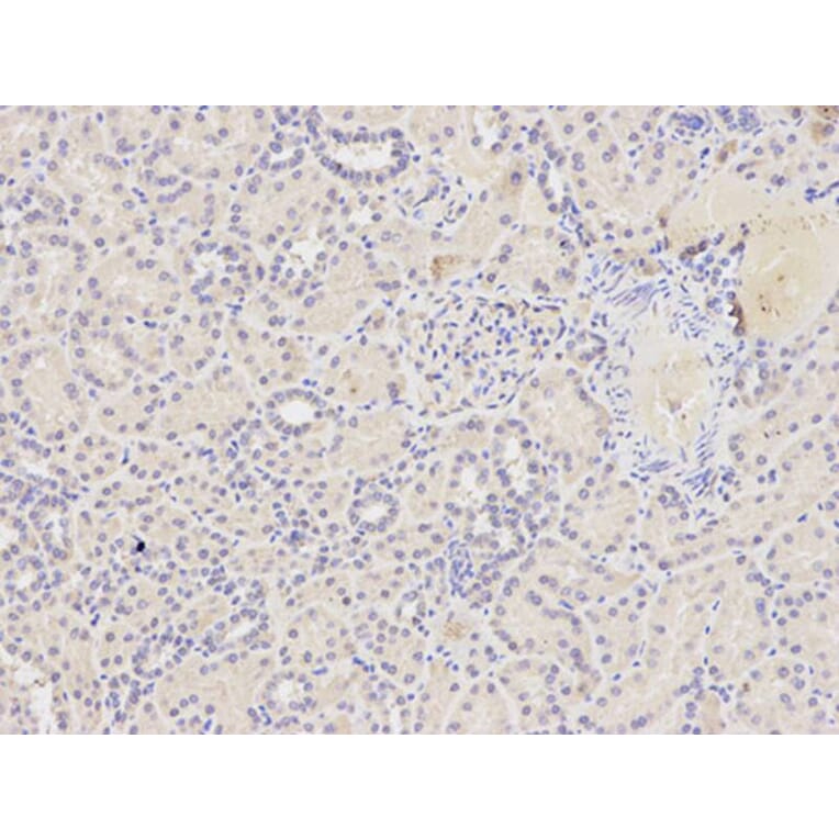 Immunohistochemistry - FAS Antibody from Signalway Antibody (32031) - Antibodies.com