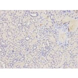 Immunohistochemistry - FAS Antibody from Signalway Antibody (32031) - Antibodies.com