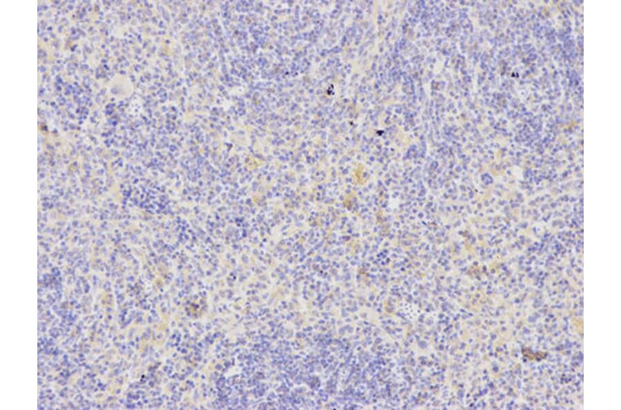 Immunohistochemistry - FAS Antibody from Signalway Antibody (32031) - Antibodies.com