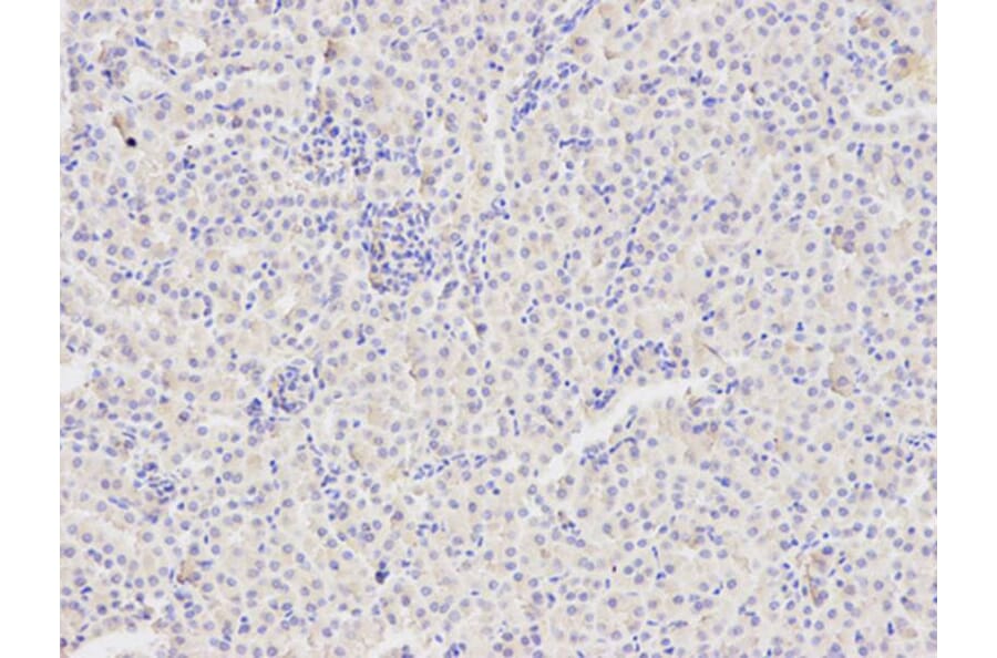 Immunohistochemistry - FAS Antibody from Signalway Antibody (32031) - Antibodies.com