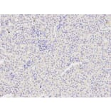 Immunohistochemistry - FAS Antibody from Signalway Antibody (32031) - Antibodies.com