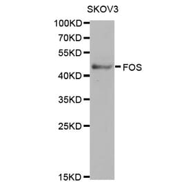 Western blot - FOS Antibody from Signalway Antibody (32032) - Antibodies.com