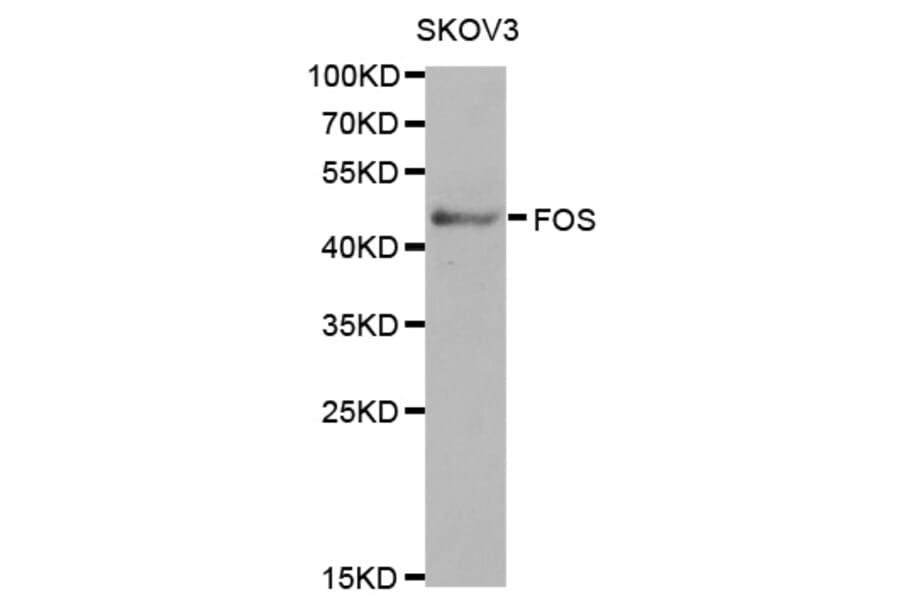 Western blot - FOS Antibody from Signalway Antibody (32032) - Antibodies.com