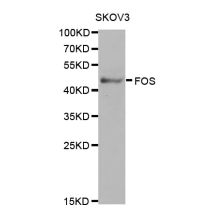Western blot - FOS Antibody from Signalway Antibody (32032) - Antibodies.com