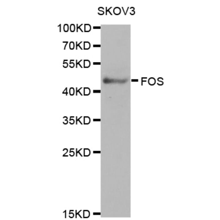 Western blot - FOS Antibody from Signalway Antibody (32032) - Antibodies.com