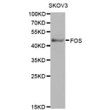 Western blot - FOS Antibody from Signalway Antibody (32032) - Antibodies.com