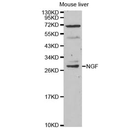 Western blot - NGF Antibody from Signalway Antibody (32048) - Antibodies.com