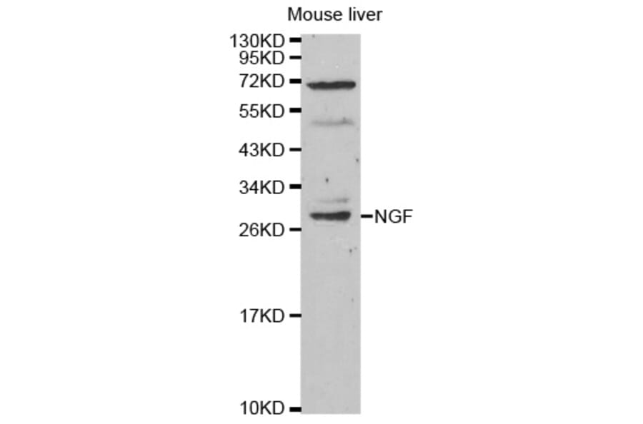 Western blot - NGF Antibody from Signalway Antibody (32048) - Antibodies.com