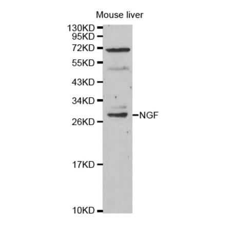 Western blot - NGF Antibody from Signalway Antibody (32048) - Antibodies.com