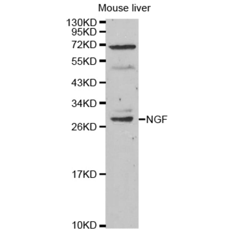Western blot - NGF Antibody from Signalway Antibody (32048) - Antibodies.com