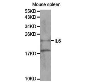 Western blot - IL6 Antibody from Signalway Antibody (32064) - Antibodies.com