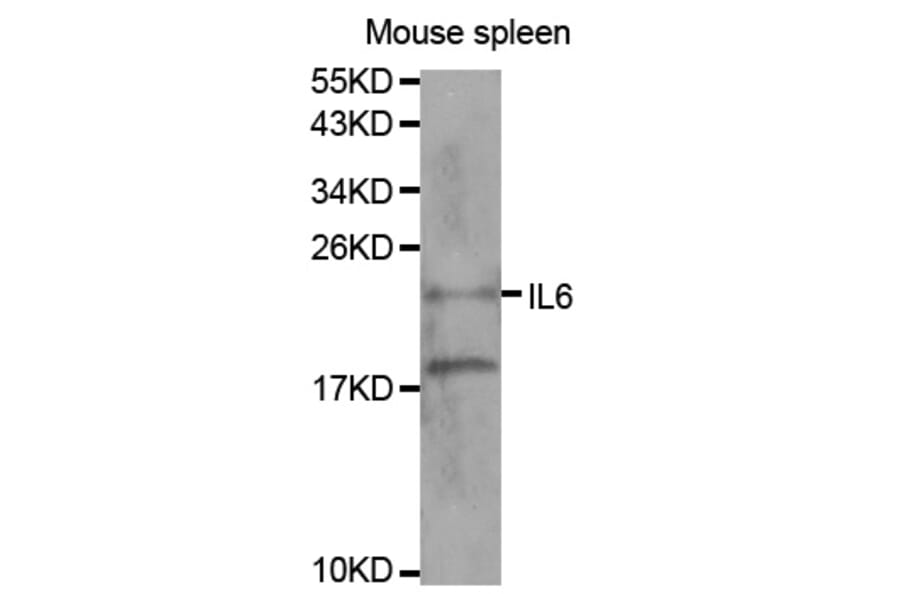 Western blot - IL6 Antibody from Signalway Antibody (32064) - Antibodies.com