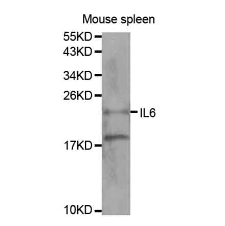 Western blot - IL6 Antibody from Signalway Antibody (32064) - Antibodies.com