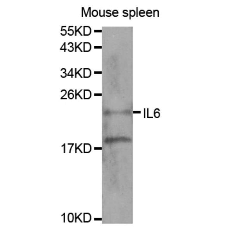 Western blot - IL6 Antibody from Signalway Antibody (32064) - Antibodies.com