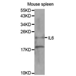 Western blot - IL6 Antibody from Signalway Antibody (32064) - Antibodies.com