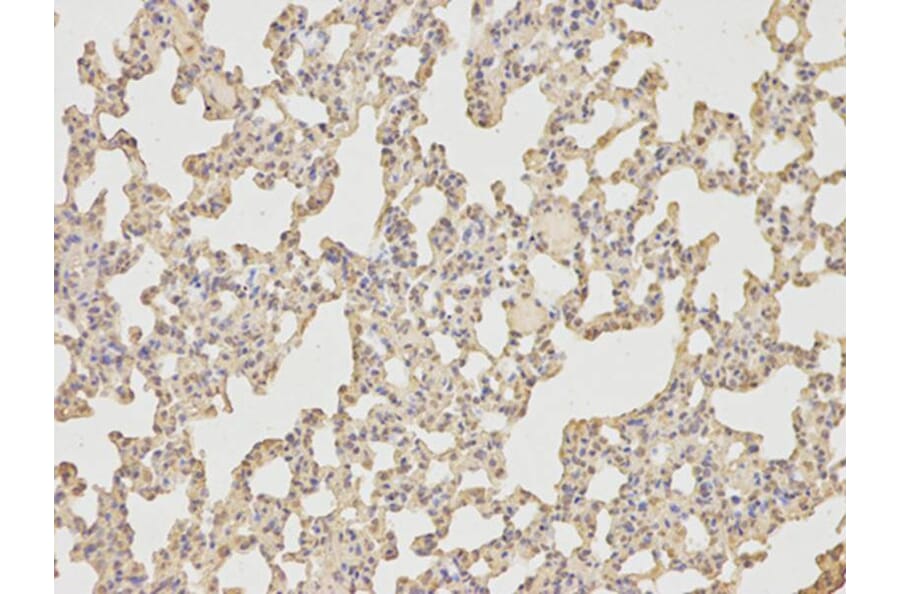 Immunohistochemistry - IL6 Antibody from Signalway Antibody (32064) - Antibodies.com