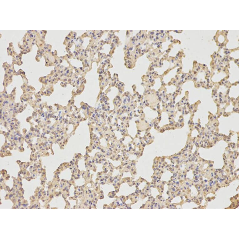 Immunohistochemistry - IL6 Antibody from Signalway Antibody (32064) - Antibodies.com
