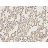 Immunohistochemistry - IL6 Antibody from Signalway Antibody (32064) - Antibodies.com
