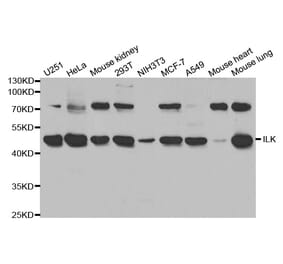 Western blot - ILK Antibody from Signalway Antibody (32090) - Antibodies.com