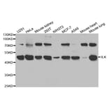 Western blot - ILK Antibody from Signalway Antibody (32090) - Antibodies.com