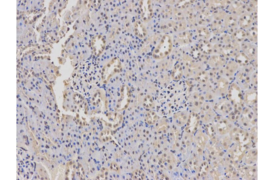 Immunohistochemistry - WAS Antibody from Signalway Antibody (32105) - Antibodies.com