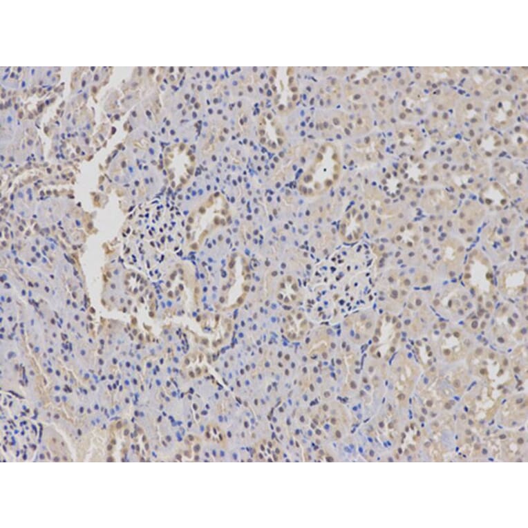 Immunohistochemistry - WAS Antibody from Signalway Antibody (32105) - Antibodies.com