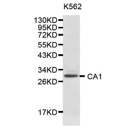 Western blot - CA1 Antibody from Signalway Antibody (32127) - Antibodies.com