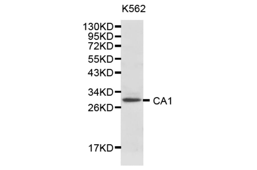 Western blot - CA1 Antibody from Signalway Antibody (32127) - Antibodies.com