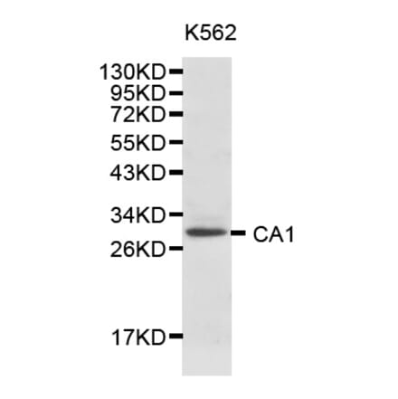 Western blot - CA1 Antibody from Signalway Antibody (32127) - Antibodies.com