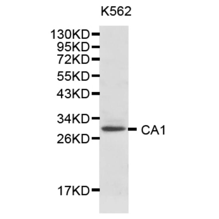 Western blot - CA1 Antibody from Signalway Antibody (32127) - Antibodies.com