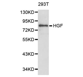 Western blot - HGF Antibody from Signalway Antibody (32218) - Antibodies.com