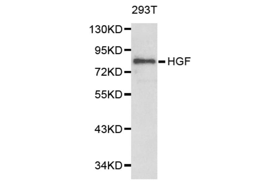 Western blot - HGF Antibody from Signalway Antibody (32218) - Antibodies.com