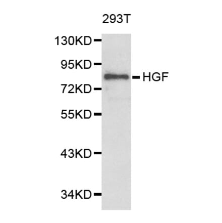 Western blot - HGF Antibody from Signalway Antibody (32218) - Antibodies.com