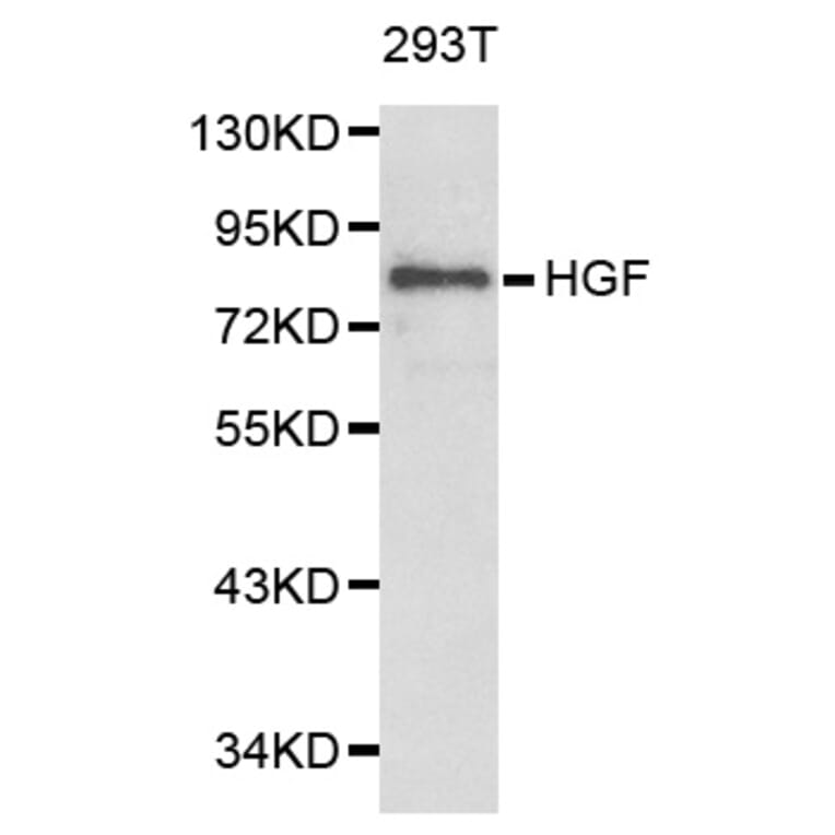 Western blot - HGF Antibody from Signalway Antibody (32218) - Antibodies.com