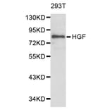 Western blot - HGF Antibody from Signalway Antibody (32218) - Antibodies.com