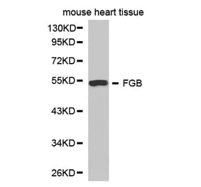 Western blot - FGB Antibody from Signalway Antibody (32273) - Antibodies.com