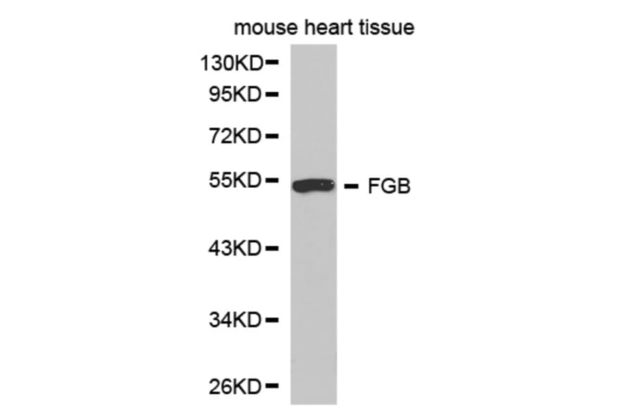 Western blot - FGB Antibody from Signalway Antibody (32273) - Antibodies.com