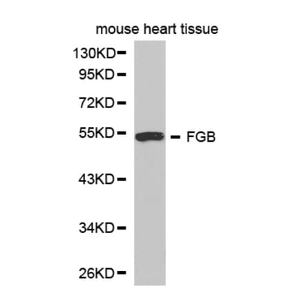 Western blot - FGB Antibody from Signalway Antibody (32273) - Antibodies.com