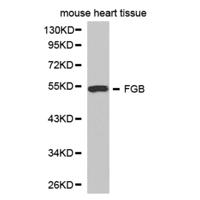 Western blot - FGB Antibody from Signalway Antibody (32273) - Antibodies.com