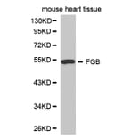 Western blot - FGB Antibody from Signalway Antibody (32273) - Antibodies.com