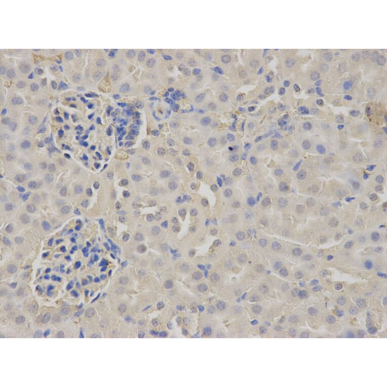Immunohistochemistry - FGB Antibody from Signalway Antibody (32273) - Antibodies.com
